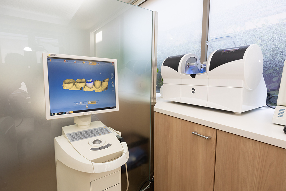 セレックシステムについて